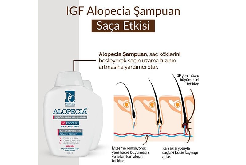 IGF Yeni Saç Çıkarır Mı?