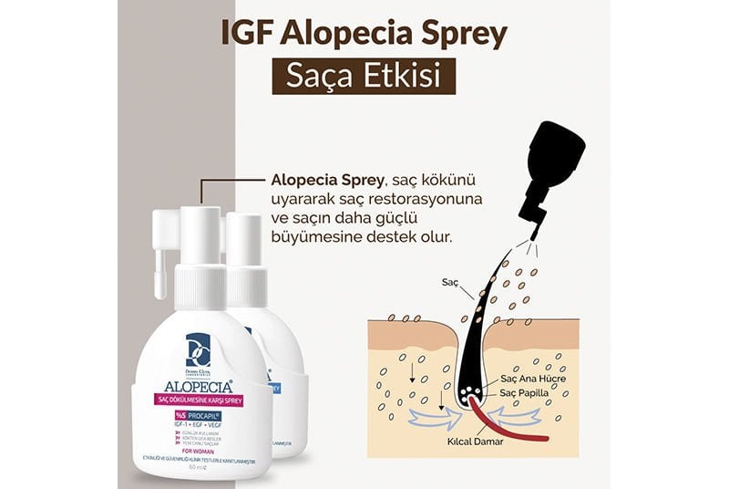 IGF, Procapil ve Saw Palmetto İçerikli Alopecia Saç Spreyinin Saça Etkisi